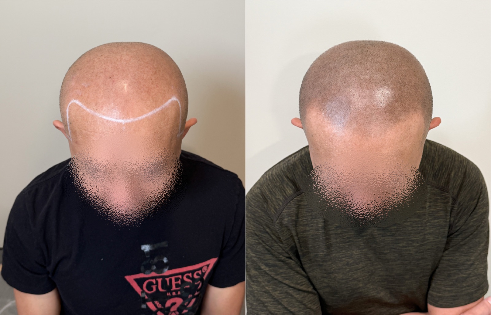 Shaved look SMP portfolio 8